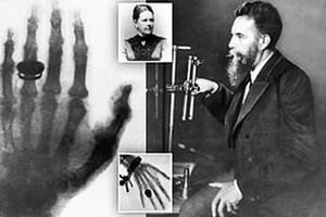 history-of-x-ray-machine